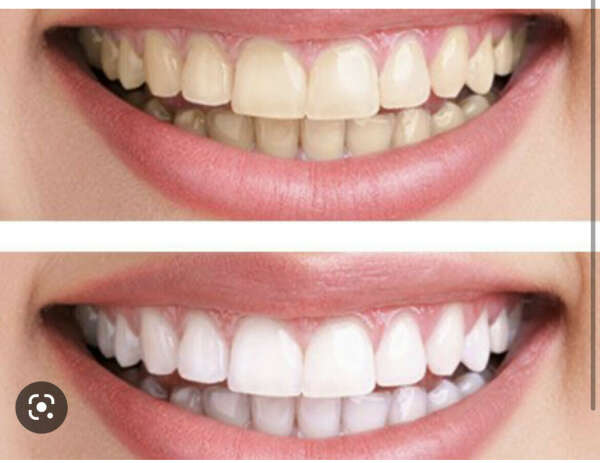 Белые зубки