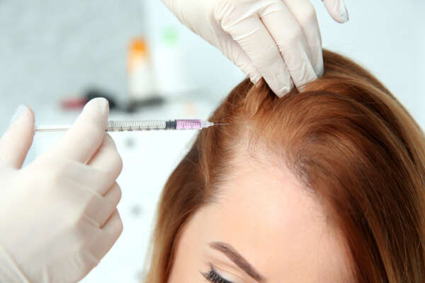 Курс мезотерапии для волос