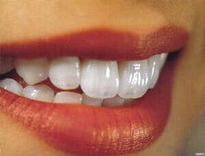 хочу красивые зубы в полном составе