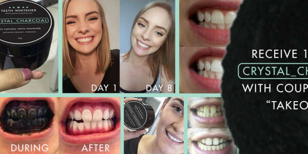 Natural Teeth Whitening Charcoal for Sale at Best Price