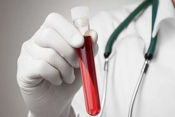 Определить свою группу крови