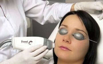 Fraxel Laser для лица