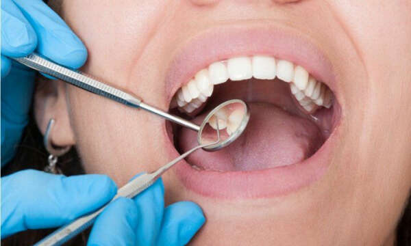 Вылечить зубы