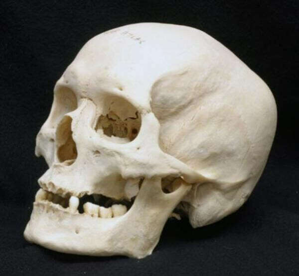 Гипсовая модель черепа