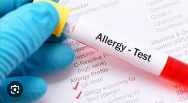 Анализы на аллергены